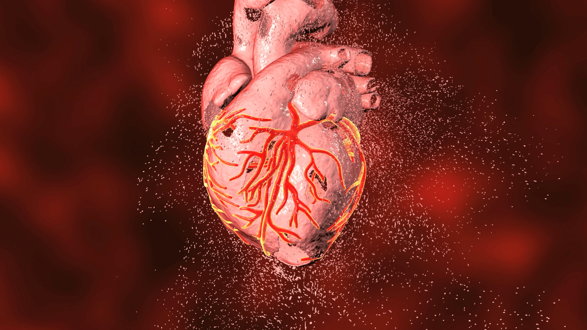 coronary heart disease
